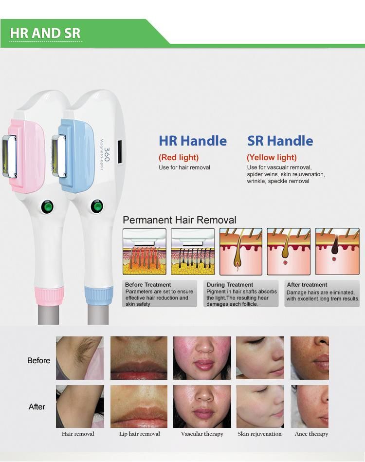 Factory Promotion Price Hot Selling IPL Hair Removal Beauty Machine Shr Double Opt with Ce RoHS