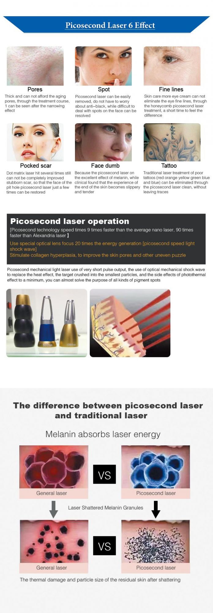 Renlang Picosecond Laser for Tattoo Removal Machine