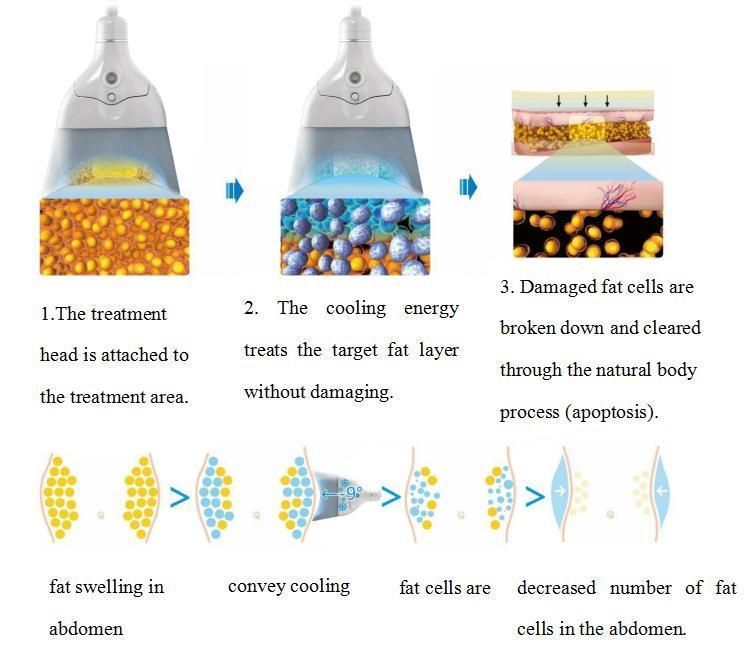 Az CE Approved Sincoheren Diamond Coolplas Body Contouring Without Surgery and Downtime