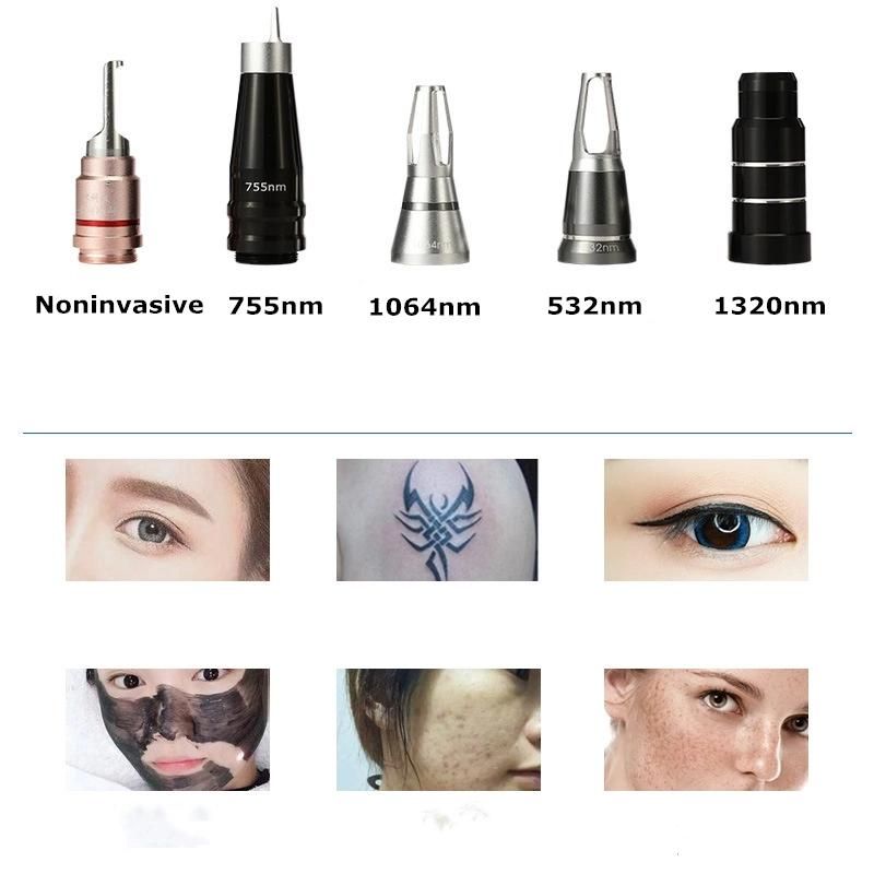 Portable Tattoo Removal Carbon Peeling Pigmentation Removal ND YAG Laser