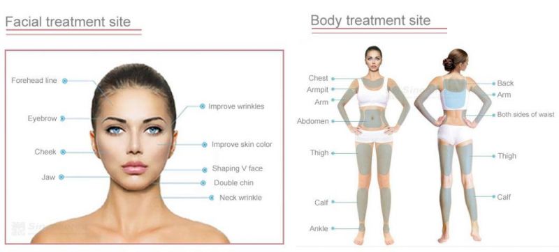 Hifu Smas Face Lifting Second Generation U One Hifu 4D Skin Tightening 60000 Shots V Max Hifu Medical Beauty Machine