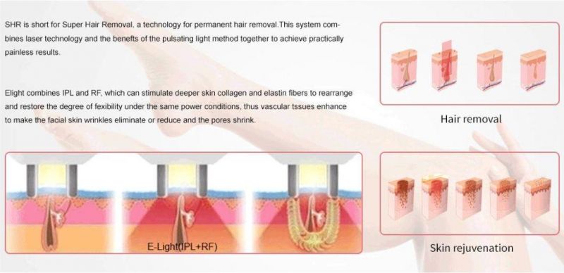 Az TUV Approved IPL Multifunction Face Lift Shr IPL Laser Hair Removal Machine Skin Rejuvenation Pigment Removal for Beauty Salon
