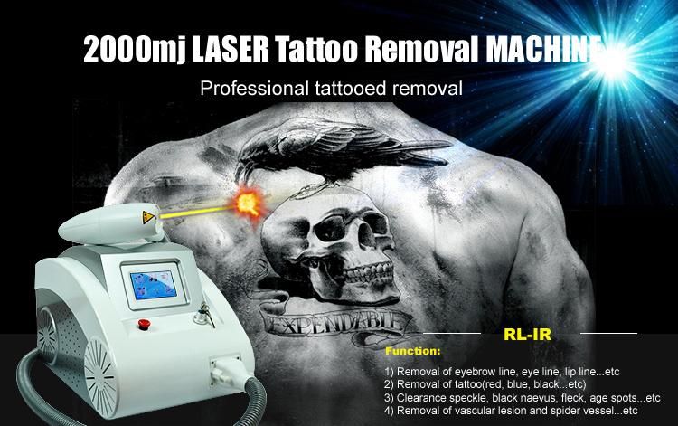 Laser Tattoo Removal Machine for Sale/Q-Switched ND YAG Laser Tattoo Removal