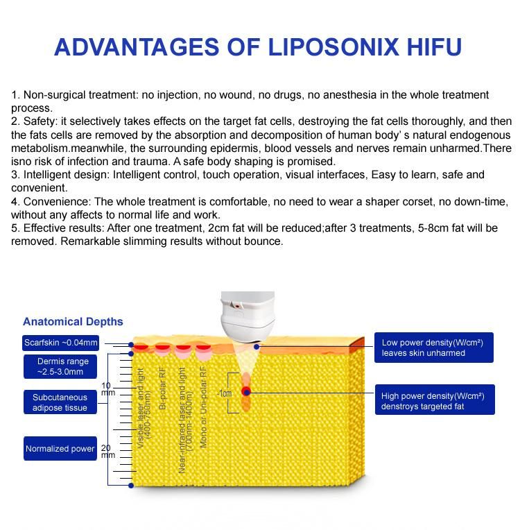 Portable Ultrasound Liposonix Machine Body Slimming Price with Liposonix Cartridge