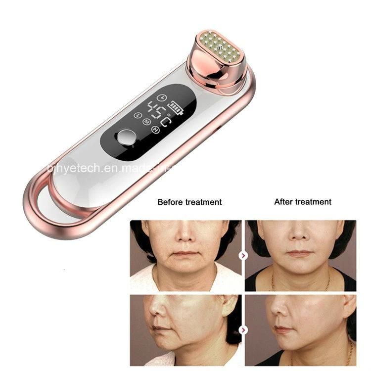 Portable Skin Tightening Face Lifting RF Machine Facial Beauty Massager