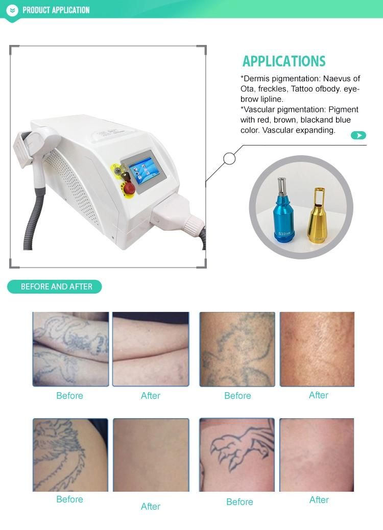 Switched Portable ND YAG Laser Tattoo Removal Machine