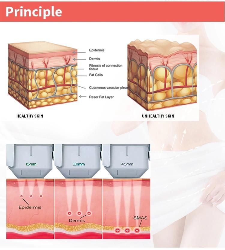 4D 5D Hifu Facial 12 Lines Ultra Lift Hifu Machine