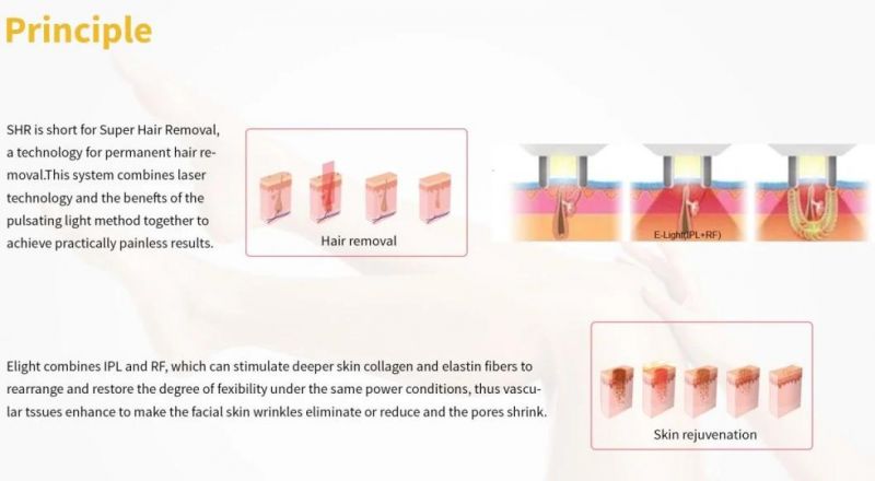 Monalisa IPL Excellent Opt IPL Multifunction Beauty Machine Skin Rejuvenation Hair Removal