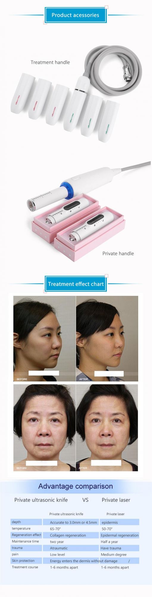 Portable Ultraformer Hifu Vmax V-Max Hifu Face Lift Machine Korea for Vaginal Tightening