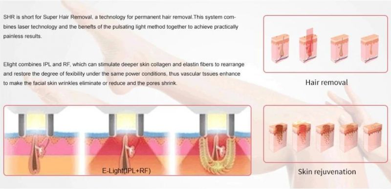 IPL Intensive Pulse Light Skin Rejuvenation Hair Removal Acne Treatment Wrinkle Removal Freckle Removal Vascular Removal Skin Care