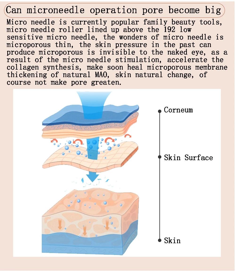 Face Massage Remove Acne 192 Needle Derma Roller