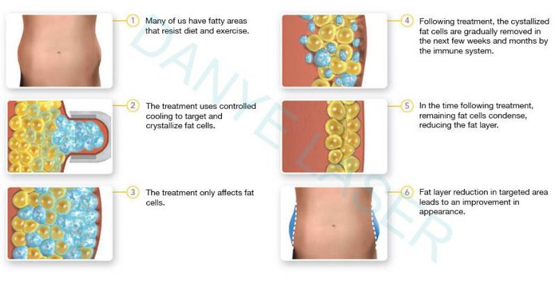 Weight Loss Freeze Fat Cell Body Slimming 360 Cryolipolysis Machine