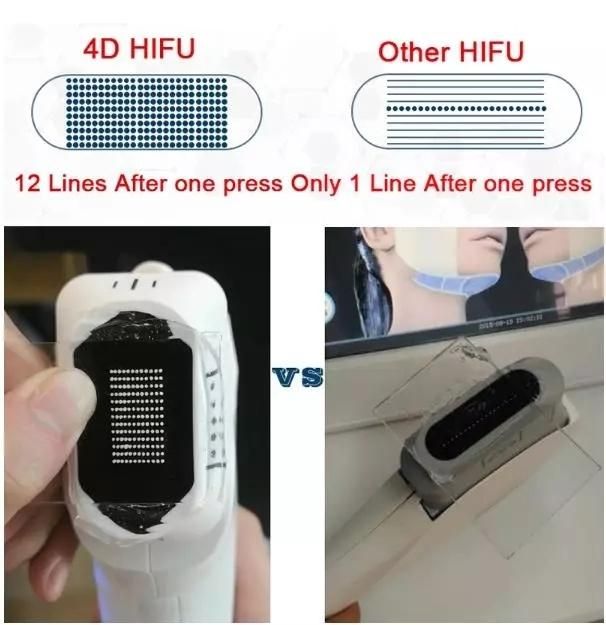 Portable 2 in 1 Radar Carving Hifu, One Press Max 12 Lines 4D Hifu Face Lift Body Slimming Machine