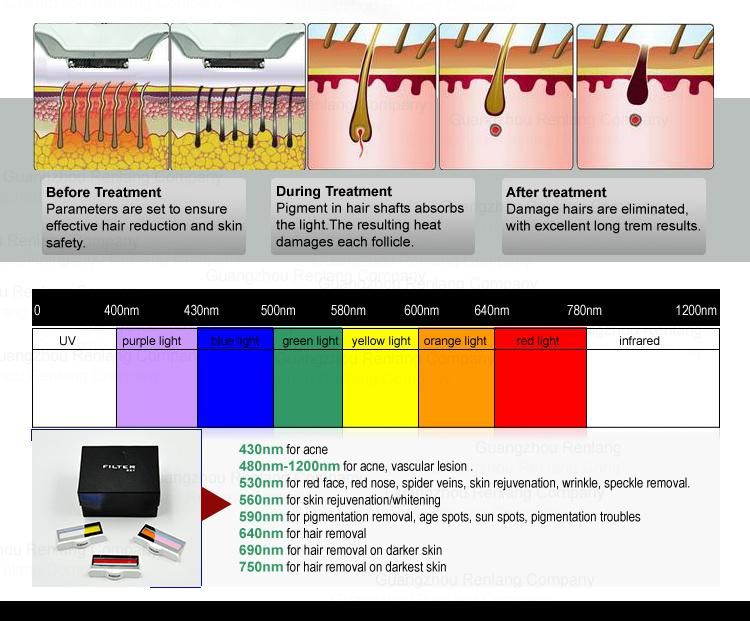 Elight Vascular Pigment Removal Shr Permanent Hair Removal Machine