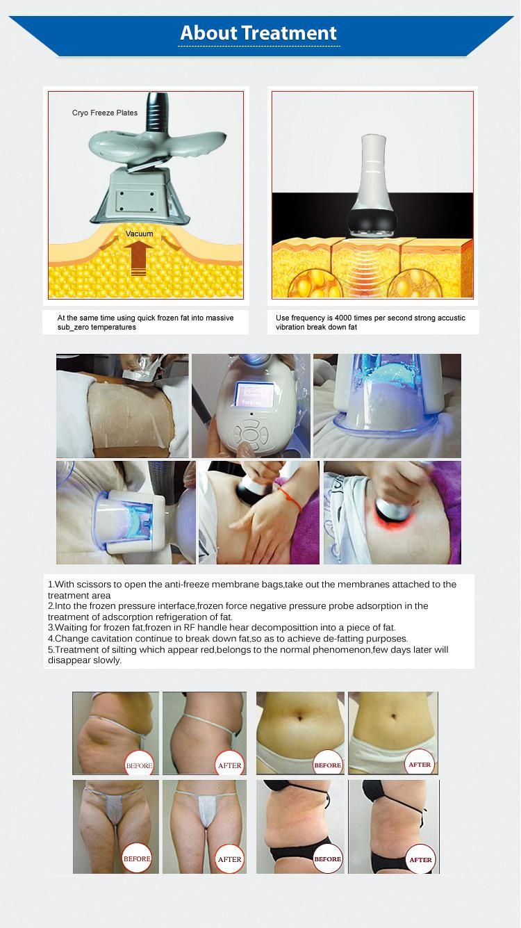 New Design Mini Portable Cryolipolysis Antifreeze Pad Weight Loss Slimming Machine for Clinic Use