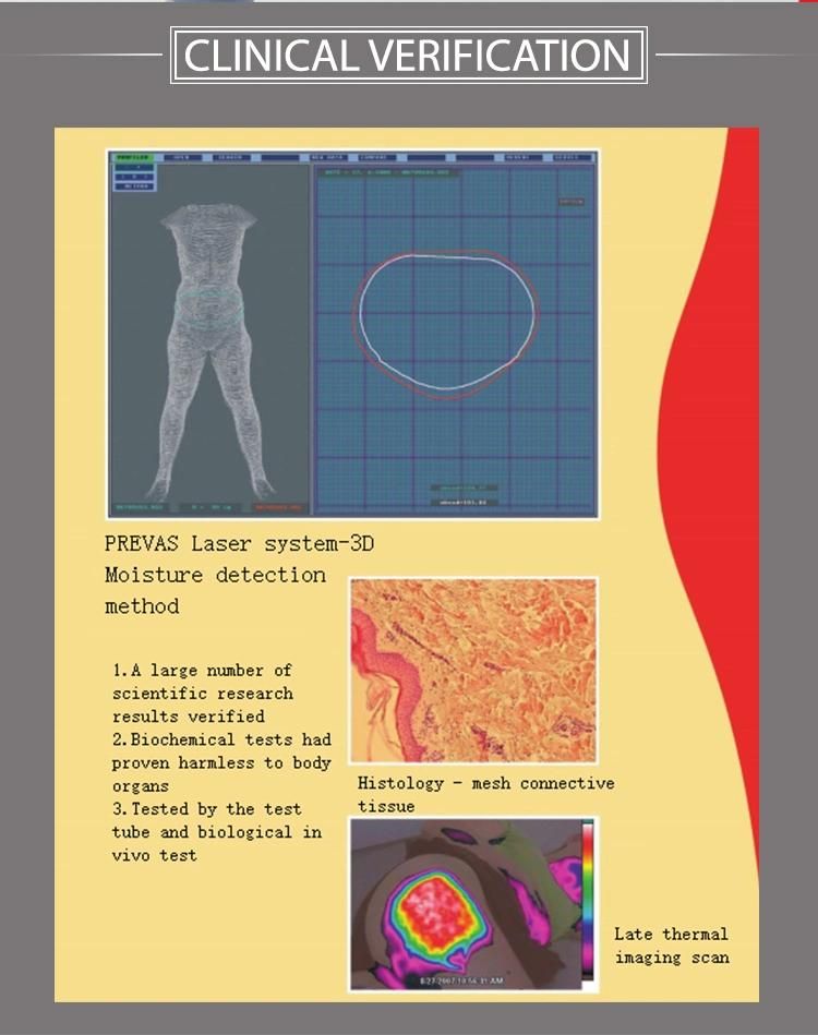 New Technology Ultrasonic Wrinkle Removal and Fat Reduction RF Device