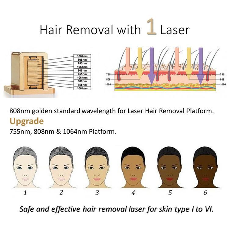 Ce FDA Approved Manufacturer 755 808 1064nm Diode Laser Permanent Hair Removal Machine with Soprano