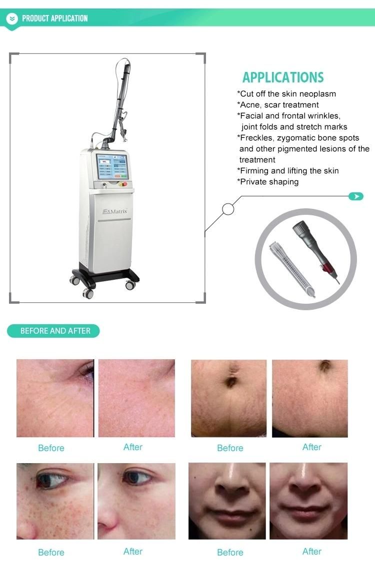 Acne Treatment Device Fractional CO2 Laser Skin Resurfacing Microcurrent Face Lift Machine Anti-Wrinkle Machine