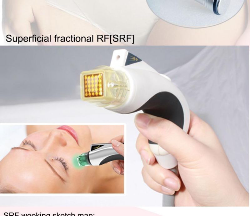 Microneedle RF Face Lifting for Pores Improval and Anti-Wrinkle Beauty Equipment (MR18-2S)