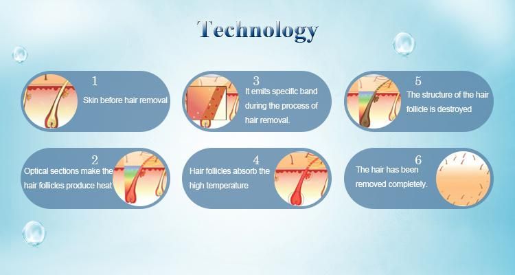 Korea Alexandrite Diode Laser Permanent Hair Removal Lumenis Lightsheer Duet Laser for Sale