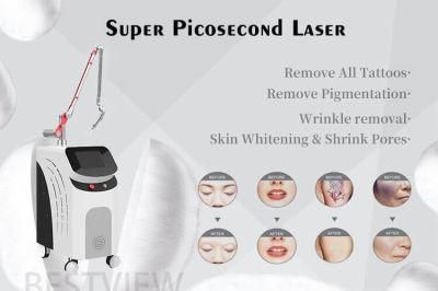 Picosecond Laser Tattoo Removal Machine Esthetician Equipment Supplier