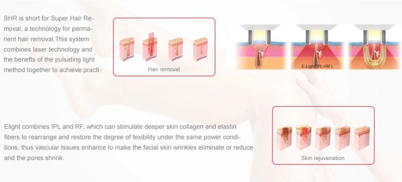 M-IPL Opt IPL Hair Removal Machine Beauty Equipment