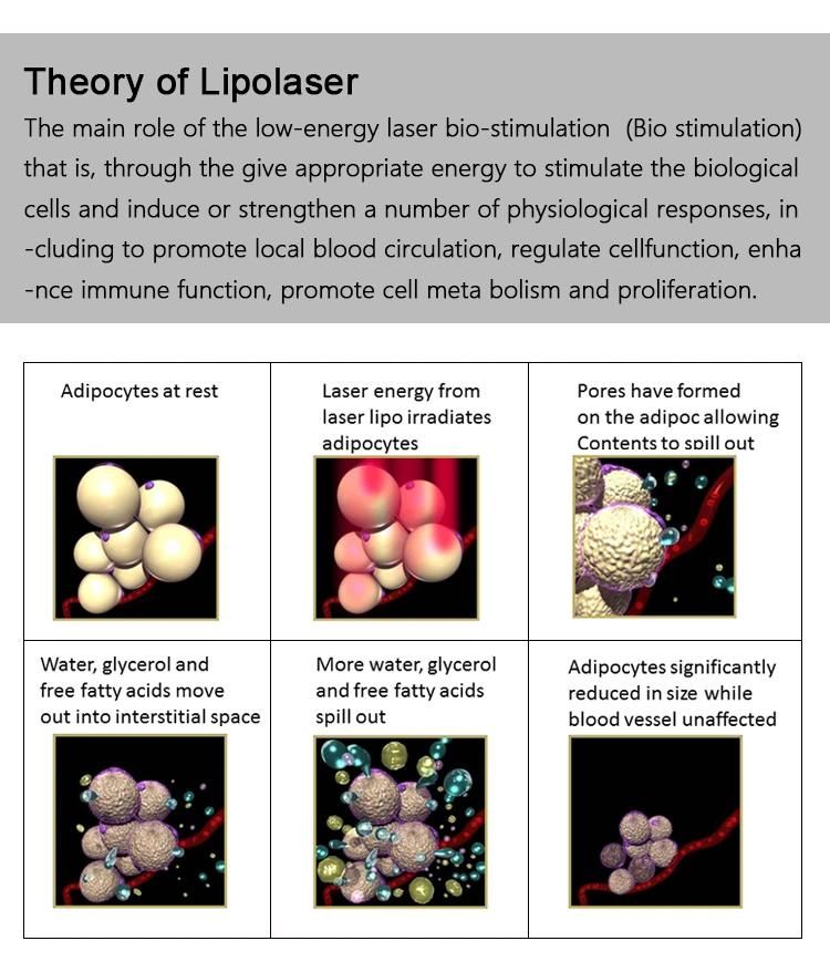 Painless Fast Fat Burner with Strong Diode Laser Mitsubishi Lipo Laser Machine