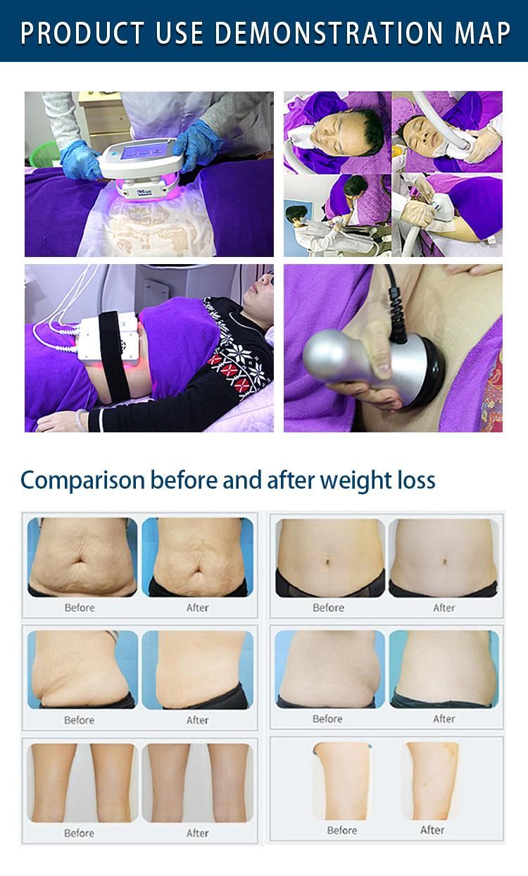 Cool Tech for Fat Reduce with Cavitation RF Lipolaser Cryolipolysis Equipment