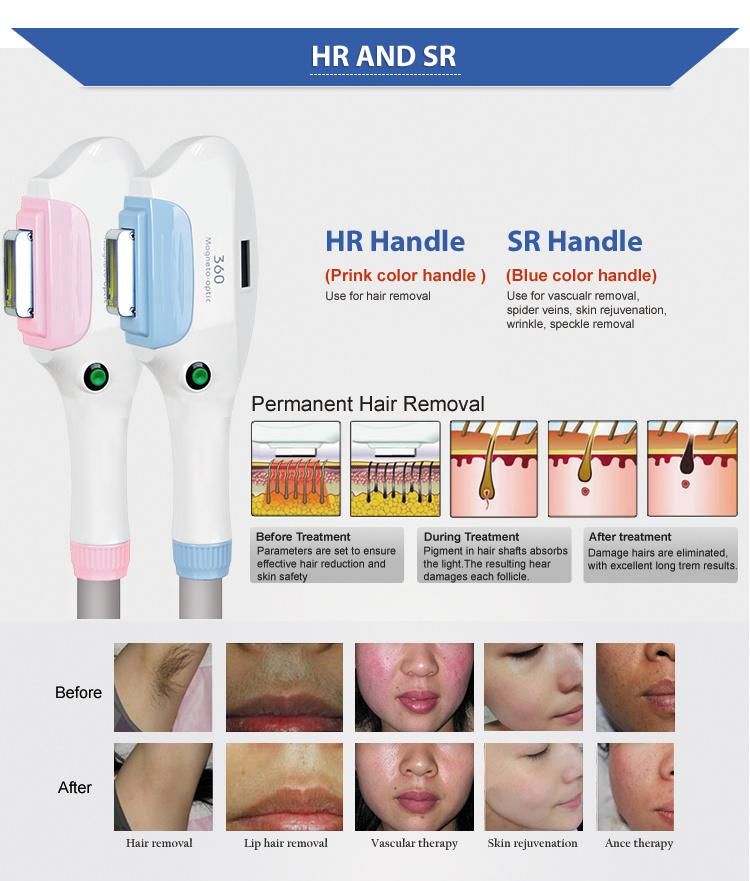 4 in 1 Sr & Hr & RF & ND YAG Laser Hair Removal Machine for Sale