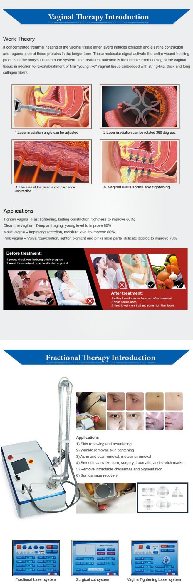 Fractional CO2 Laser Skin Rejuvenation Laser Machine