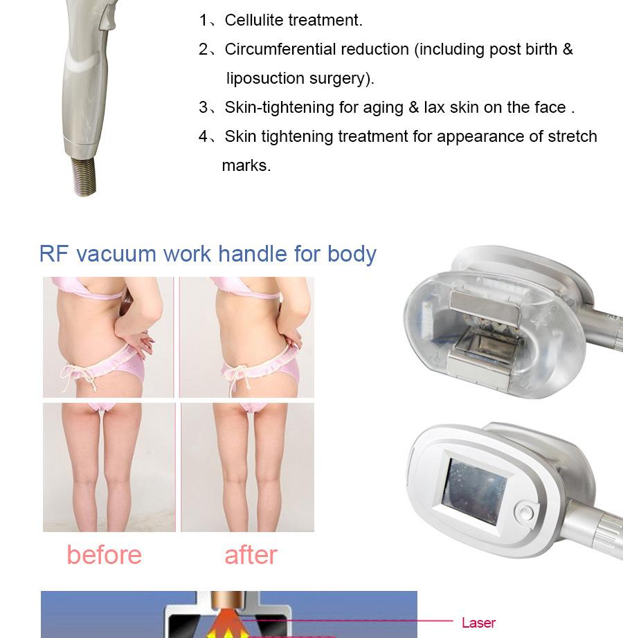 Cryolipolysis Slimming RF Vacuum Skin Tightening Beauty Machine