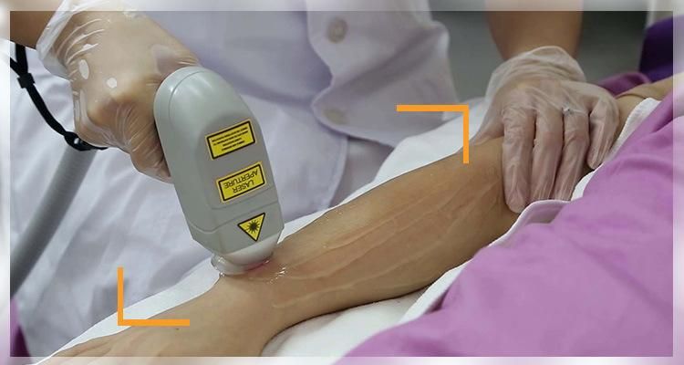 Permanent Painless Soprano 808nm Diode Laser Sapphire Cooling Hair Removal for All Skin Types