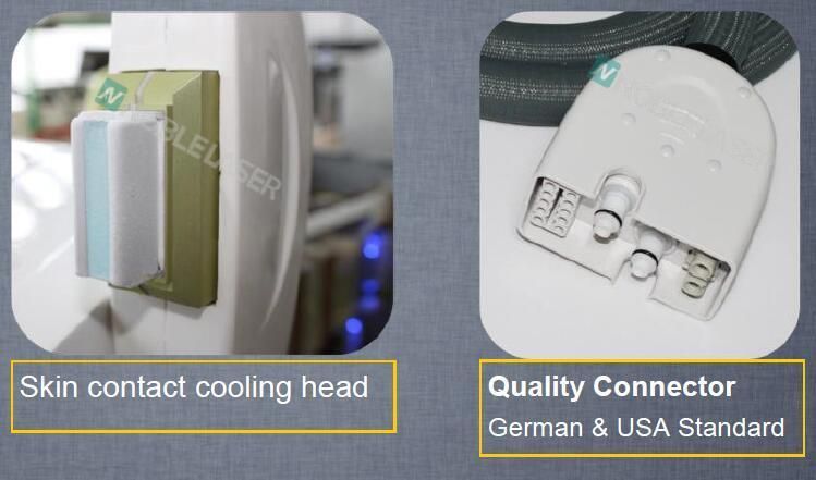 High-Tech Laser Hair Removal Machine with CE Approved (CE/ISO/TUV)