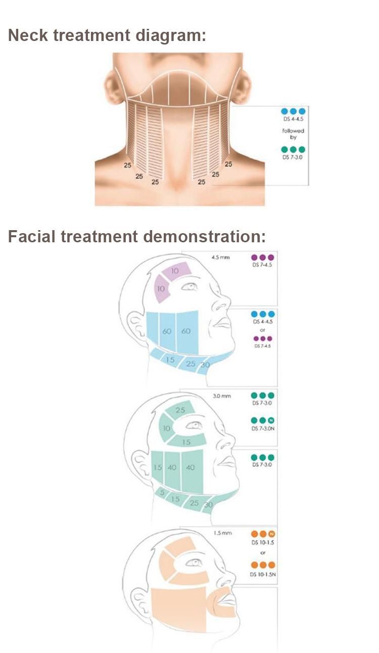 Ultraformer 3D Hifu Smas Machine Korea Portable Hifu Face Lifting