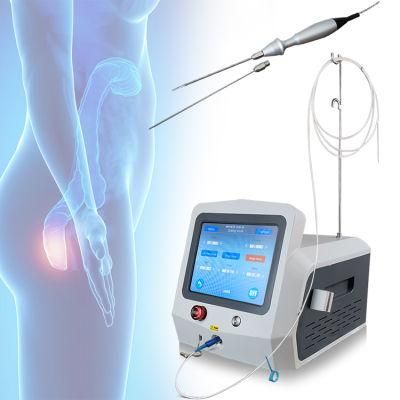 1470nm Laser for Hemorrhoid Removal Diode Laser Surgery on Proctology Hemorrhoid Anal Fistula