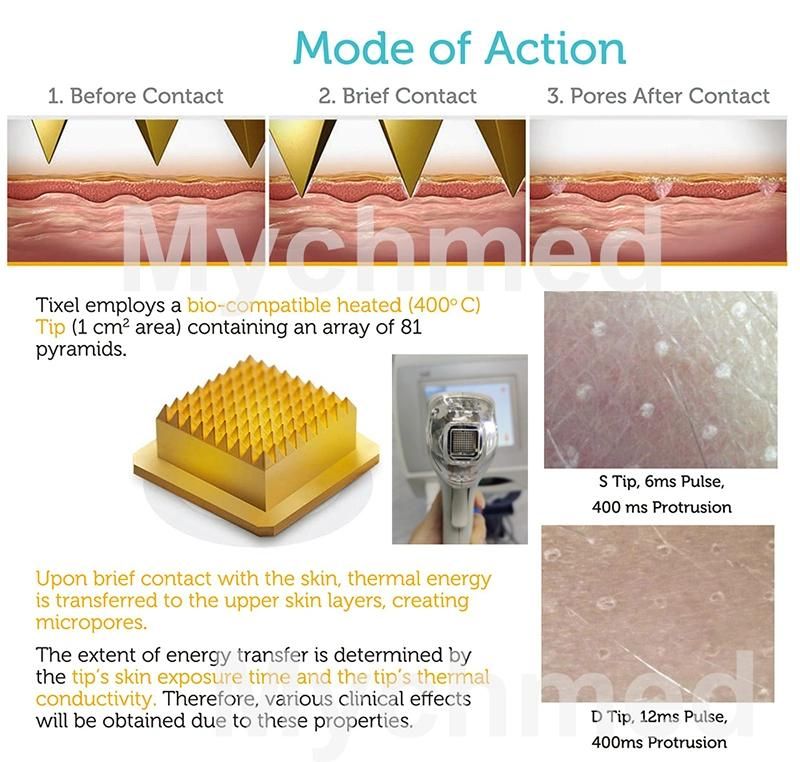 Pure Natural Heat Thermal Fractional Skin Renewal Heat Transfer Aesthetic Medical Equipment