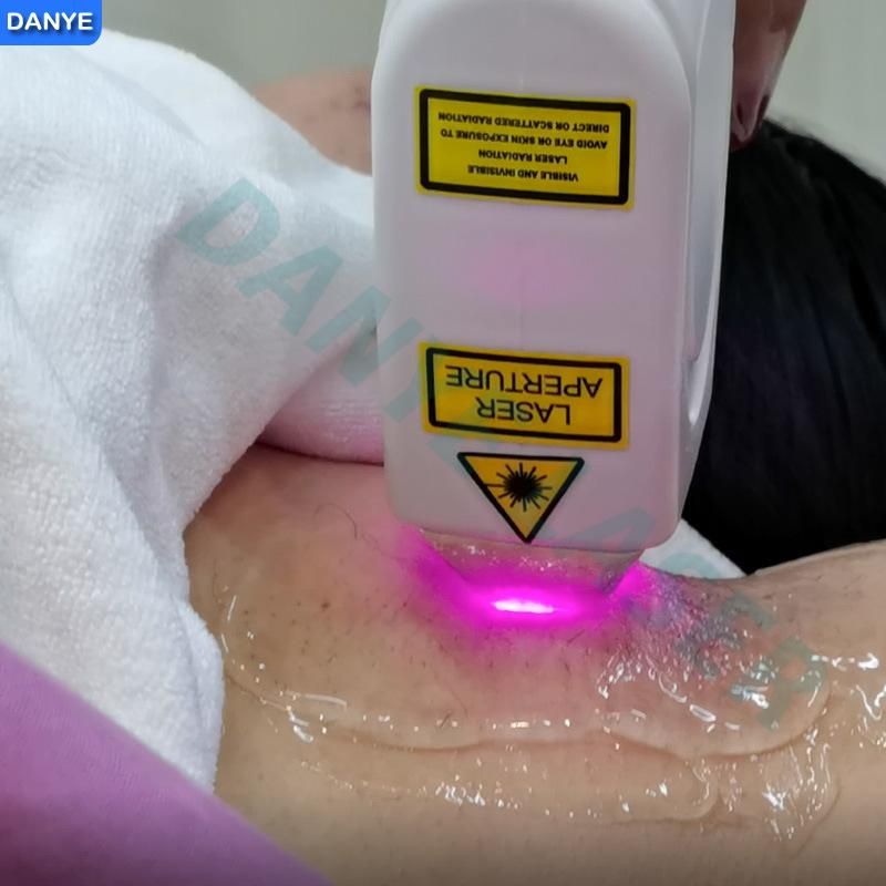 High Power 808nm Diode Laser Hair Removal Parameters