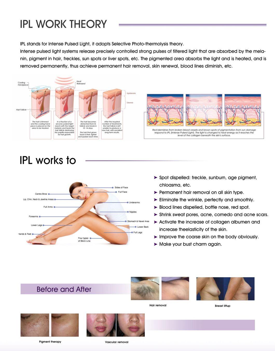 3h (E Light +IPL+RF) Pigment Removal Machine