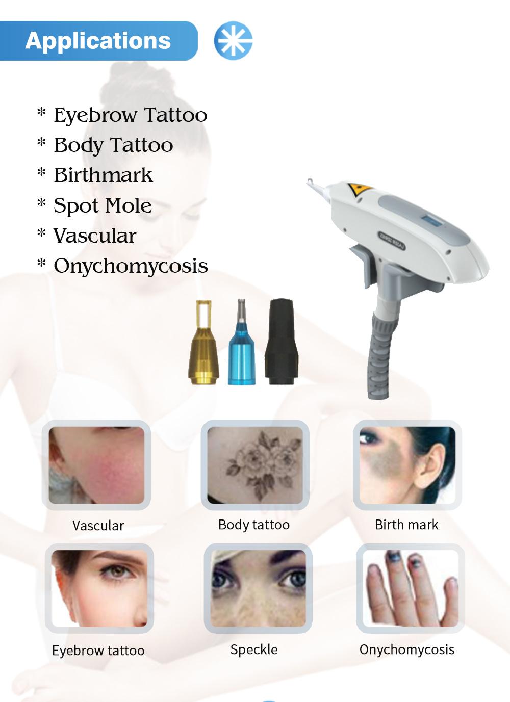 1320nm ND YAG Skin Rejuvenation and Removal Tattoo Machine