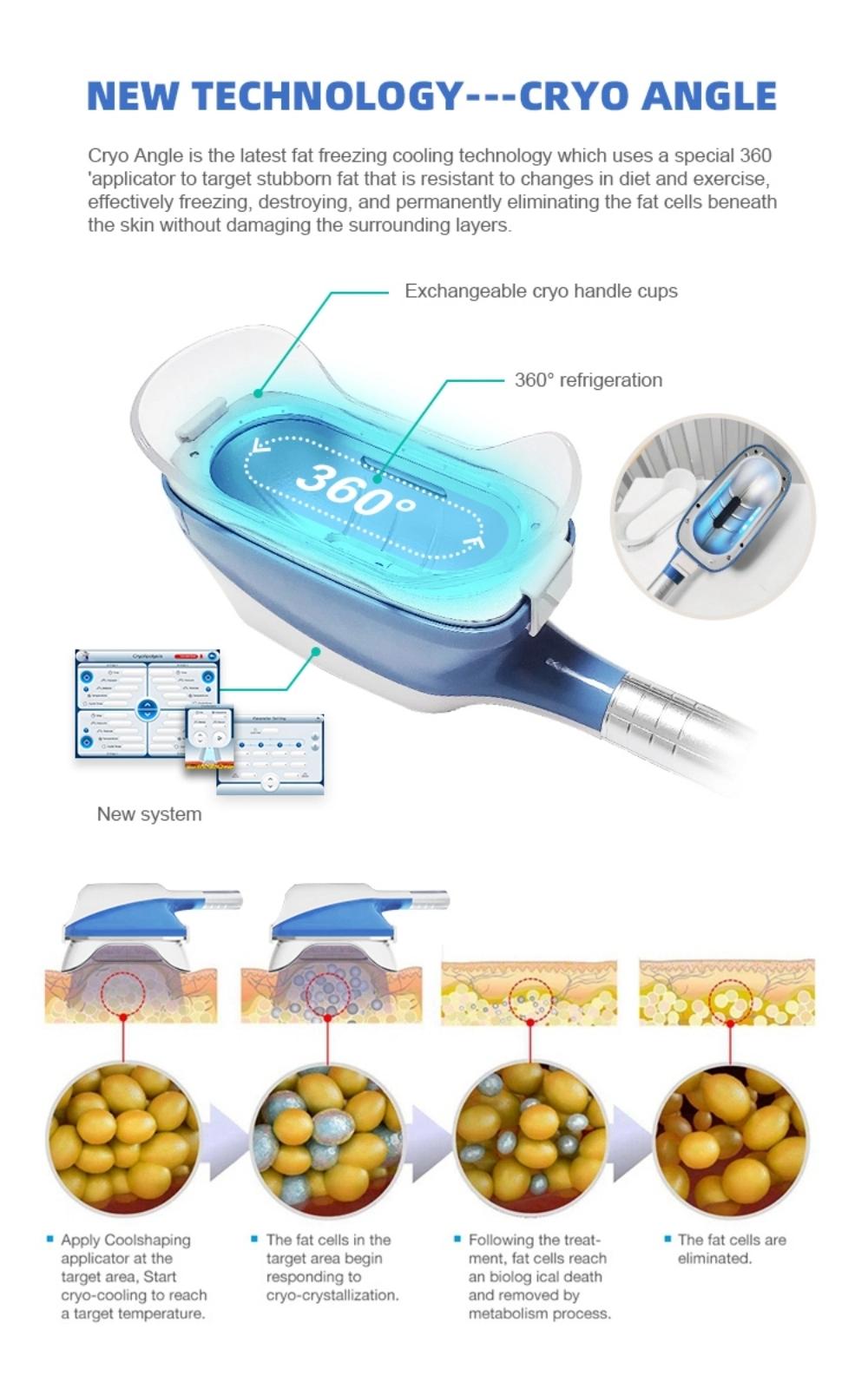 OEM ODM Service 5 Handles Double Chin Vacuum Cryolipolysis Equipment