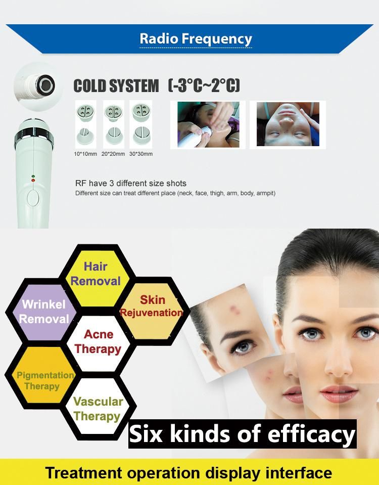 IPL Hair Removal Opt Shr Technology All Type of Hair
