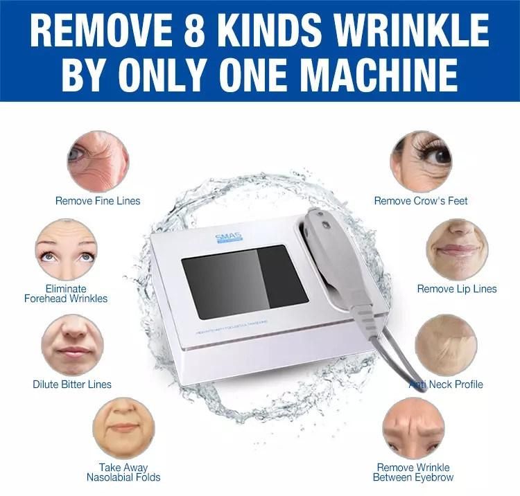 Mini Ultrasonic Hifu Face Lifting Wrinkle Removal Machine