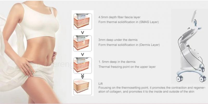 7D Hifu Body Slimming Cellulite Removal Ultrasound Cartridges 30000 Shots / Face Lifting Cartrtidge 20000 Shots Device