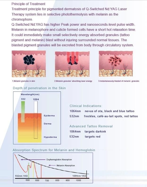 Q Switch ND YAG Laser Permanent Tattoo Removal and Eyebrow Laser Tattoo Removal