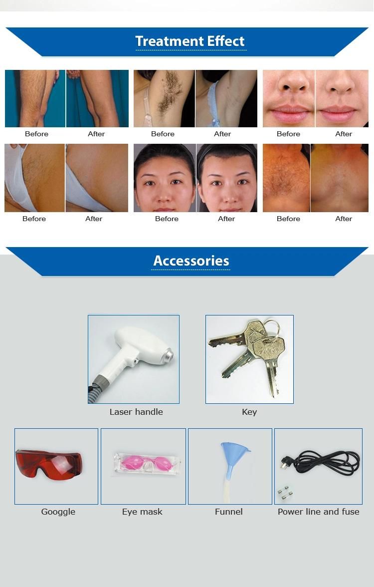 808nm Diode Laser Machine for Faster Hair Removal