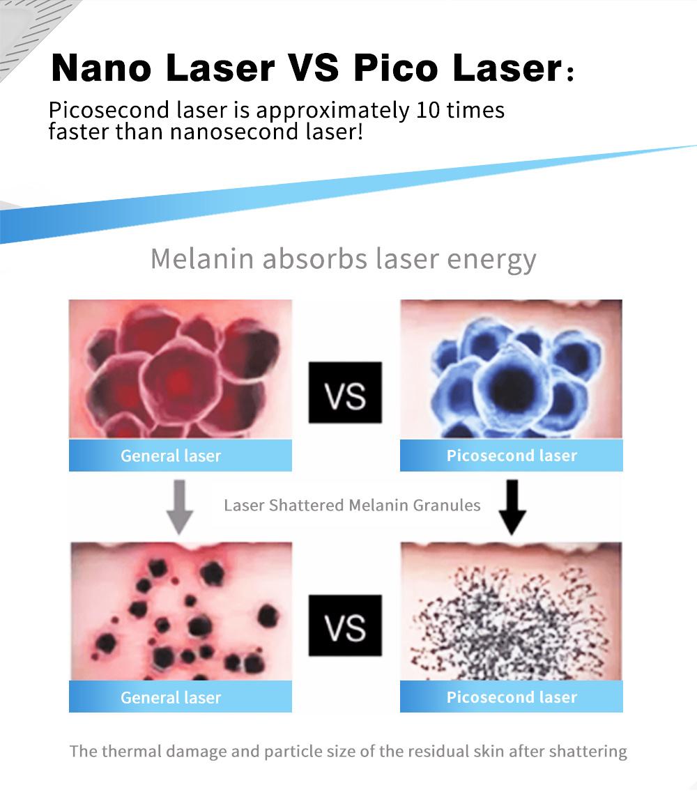 Picosecond Laser Tattoo Removal Tattoo Eraser Pigmentation Freckles Removal Beauty Salon Machine