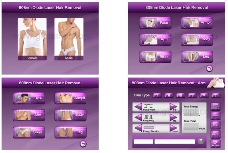 Non Channel 755nm 1064nm 808nm Diode Laser for Painless Hair Removal Machine