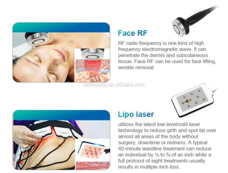 360 Cryolipolysis RF Vacuum Cavitation Lipo Laser 5 Handles Fat Loss Cryo Machine Fat Freeze RF Cavitation Cryolipolysis