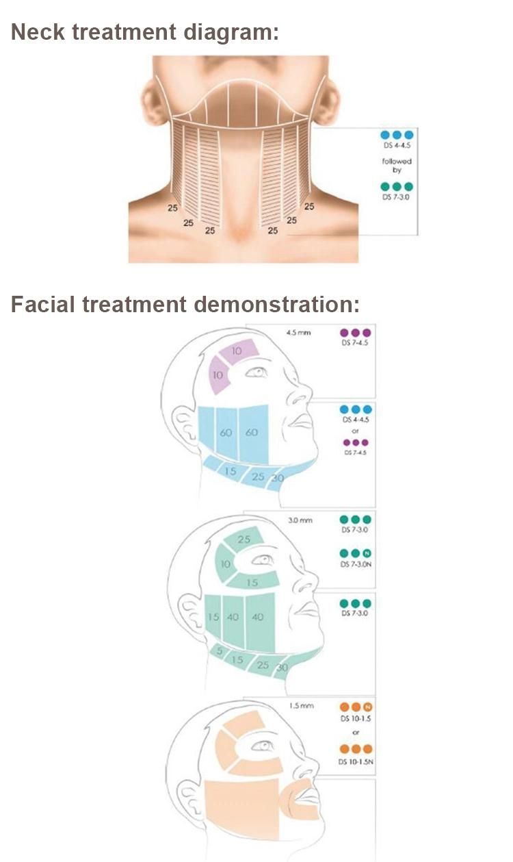 Hifu Neck Lifting Ultrasound for Face Tightening Eye Bags Removal