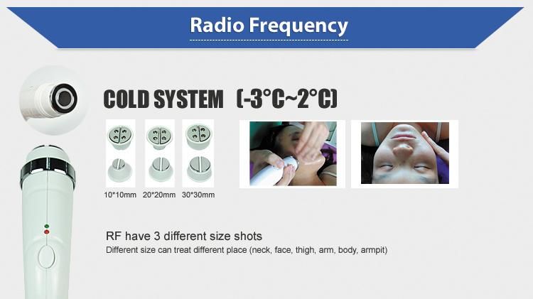 Super Elight IPL RF & ND YAG Laser Multifunctional Machine